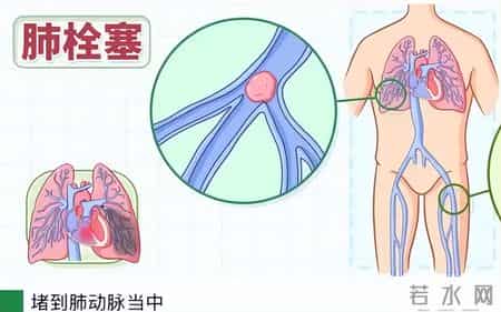 气温下降，医生呼吁中老年：宁多出门遛弯，也别忽视3种健康隐患