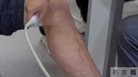 穿了十几年的医用弹力袜，为什么腿上还是有静脉曲张？