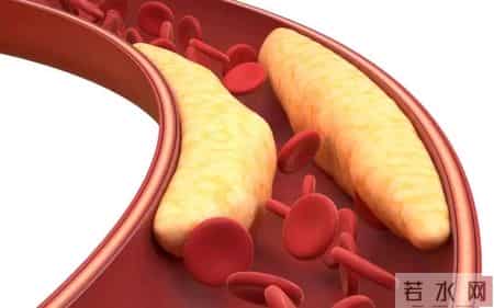 橙子再次被关注！医生发现：冠心病患者常吃橙子，或出现7种变化