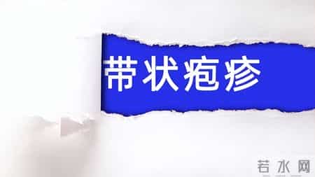 人不会平白无故患带状疱疹？医生：患带状疱疹，或有5个隐藏原因