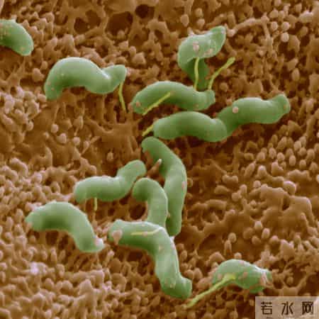 陈皮被关注！医生发现：胃病患者常喝陈皮茶，或有3个改善！