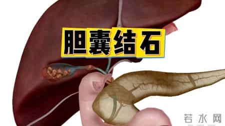 再这样吃饭，胰腺就废了！忠告：吃饭不注意4点，是在给胰腺上刑