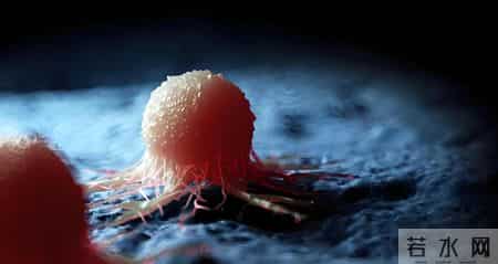 切了还会复发吗？医生：关于前列腺手术的5个真相，术前要看清