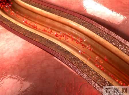 医生研究发现：经常吃豆类的老人，用不了多久，身体会有3大改善