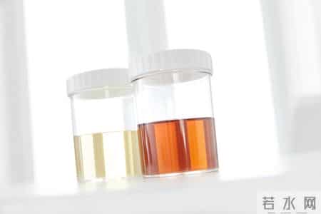 医学发现：不吃鸭肉和猪肉的人，尿酸一下就降下来了？真的吗