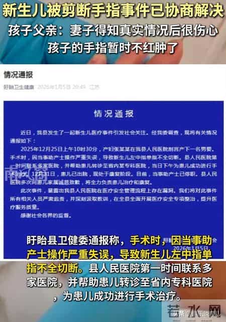 新生儿剪脐带剪断手指