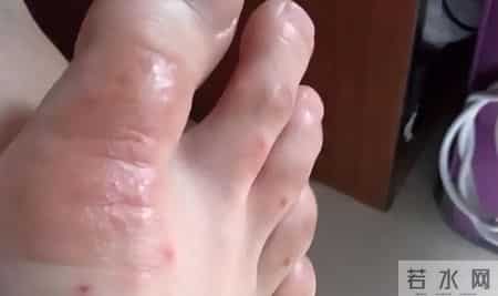 糖尿病恶化的5个身体信号！医生警告：出现1个就该重视，别再拖了