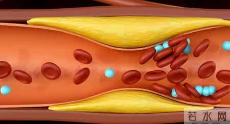 油条再次被关注！调查发现：糖尿病患者吃油条时，要多注意这5点