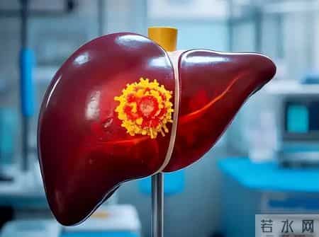 肝癌前最危险信号不是口干，而是这5个症状！