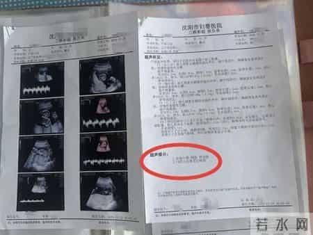 孕妇两个月内从一胎变四胞胎，每次产检都多出一胎！医生：系同卵四胞胎