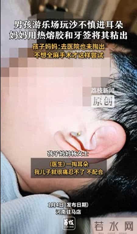 河南妈妈神操作！挖耳朵进沙求医无果，热熔胶牙签上阵成功取出