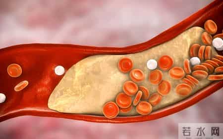 牛奶再次被关注！医生发现：高血脂人常喝牛奶，或出现这些变化