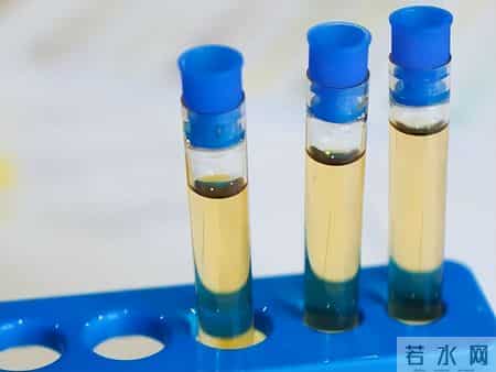 人有没有肾衰竭，看平常就知？肾病患者，日常有这6个表现！