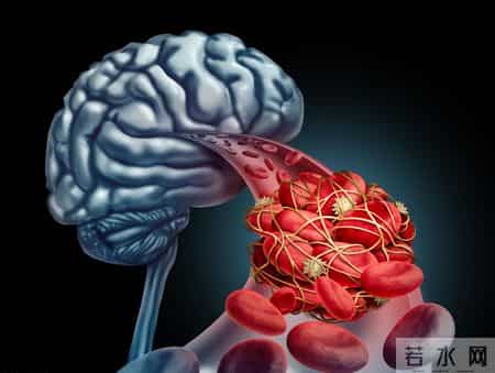 高龄老人不用吃他汀？权威研究：65岁以上高危者吃了更长寿