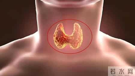 腊肉再次被关注！医生发现：甲状腺患者喜欢吃腊肉，要注意这5点