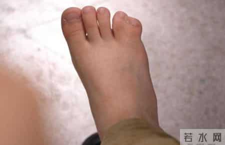 糖尿病人一根烟不能抽？医生强调：放纵一次，让你承受2个痛苦