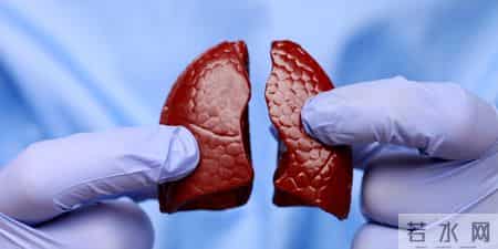 医生提醒：跟肺癌患者一起吃饭，一定要注意5件事，千万别忽视！