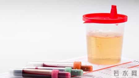 医生忠告：年过50，体检报告中出现这8个信号，或有癌变风险