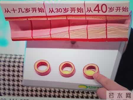 人不会无故患上冠心病？研究发现：患上冠心病，背后有4点原因