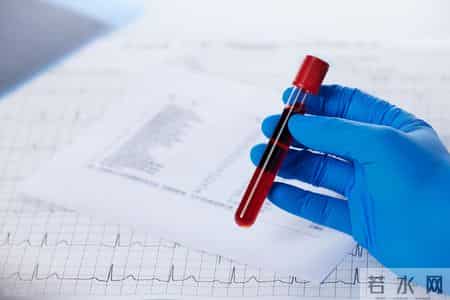 什么样的糖化血红蛋白最危险？专家：这5种异常，你了解吗