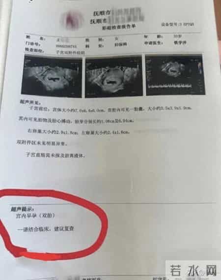 怀个孕跟开盲盒似的 一胎变四胎 还有个“小吸血鬼”