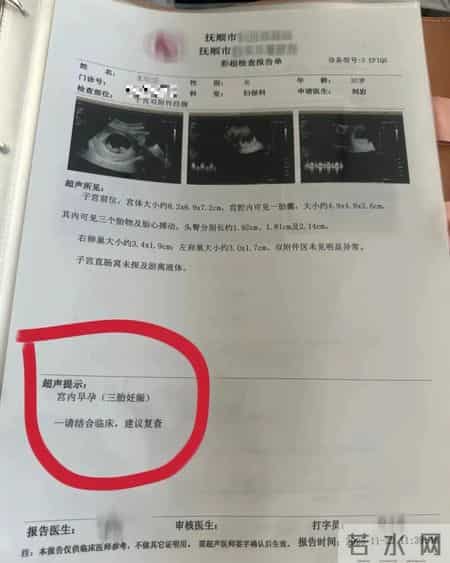 一孕妇两个月内从一胎变四胞胎，每次产检都发现多出一胎！医生解释