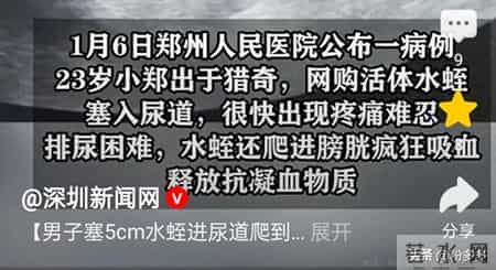 瞎胡闹！23岁男子排尿困难疼痛难忍就医，医生竟取出水蛭