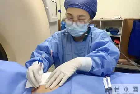 多名医生再三强调：一旦做过胸部CT，患者一定要多加关注这5点！