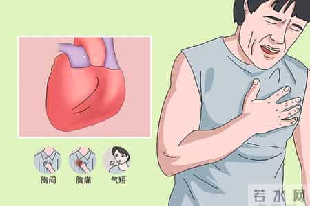 诱发冠心病加重的原因，熬夜仅排第 5，排第 1 的多数人不在意！