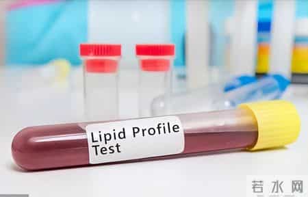 人不会无故患冠心病！研究发现：患冠心病的人，大概有这7个原因