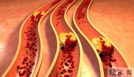 医生坦言：若是查出高血压，这3物马上停止食用，千万别害了自己