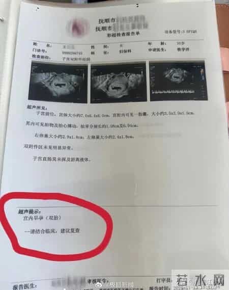 辽宁一孕妇两个月内从一胎变四胞胎，医生：系同卵四胞胎