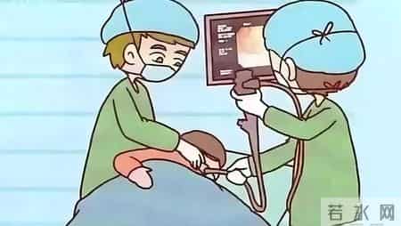 为什么很多人不愿做胃镜？医生：做一次胃镜，或能保你5年没问题