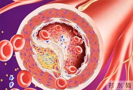 体检报告里这一项异常，竟是心脏病信号？9成人不重视，后悔太晚