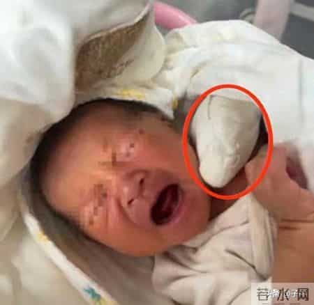 痛死了！新生儿被剪断手指紧急转院， 家属发声暂不谈赔偿太扎心