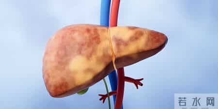 调查发现：67岁后常吃鸡蛋，患脂肪肝风险是不吃鸡蛋的数倍？