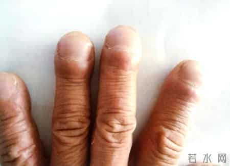 烟瘾再大也得戒！医生调查提醒：身体有这5种表现，最好把烟戒了