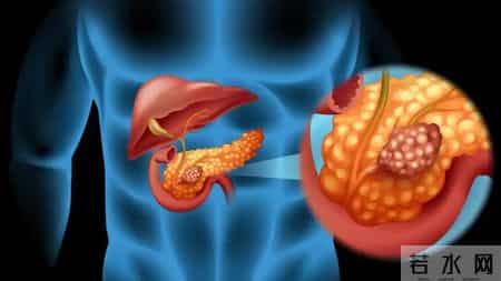 再这样吃饭，胰腺就废了！忠告：吃饭不注意4点，是在给胰腺上刑