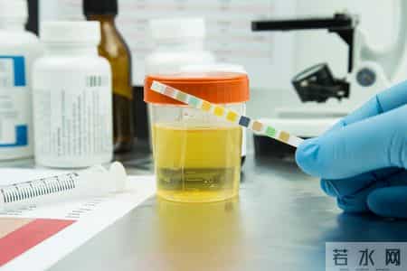 肾脏开始衰竭，排尿先知？医生提醒：排尿出现3异常，尽快去医院