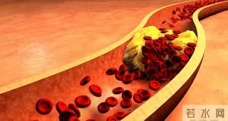 血栓和喝水有关？医生发现：越喜欢睡前喝水的老人，越容易有血栓