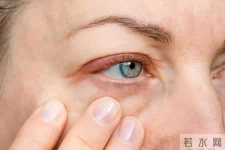 人有没有肾病，看喝水就知？医生：有肾病的人，喝水多会有8异常