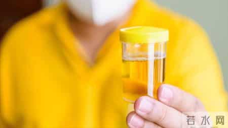 人有没有肾病，看喝水就知？医生：有肾病的人，喝水多会有6异常