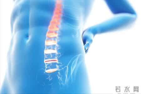 坐骨神经痛不是“腿疼”那么简单！找准原因，科学应对才不误治