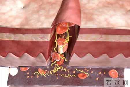 体检报告里这一项异常，竟是心脏病信号？9成人不重视，后悔太晚