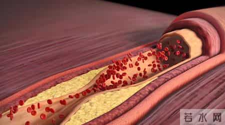 调查发现：不吃花生和鸡蛋的人，胆固醇马上就降低了？可信吗