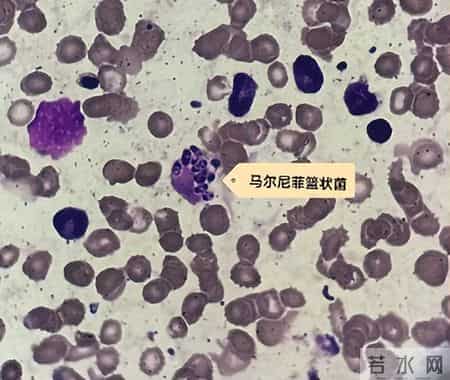 男子为滋补身体吃了它，突然高烧近40℃，肺都“烂穿”！医生：有极大风险……