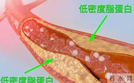 体检发现这8个信号！可能是冠心病加重前兆，别拖延及时就医评估