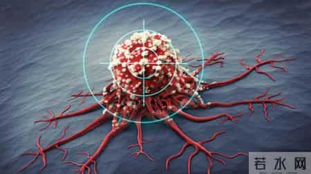 医生提醒：一滴也别喝！研究发现，全球有74万人因饮酒患癌