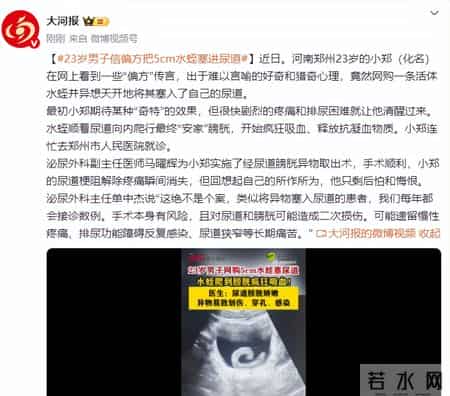 23岁男子信偏方把5cm水蛭塞进尿道致剧烈疼痛、排尿困难，就医后通过手术取出异物，医生提醒