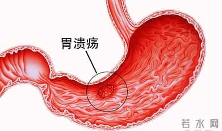 医生发现：糖尿病患者若常吃萝卜，不用多长时间，或有6大好处
